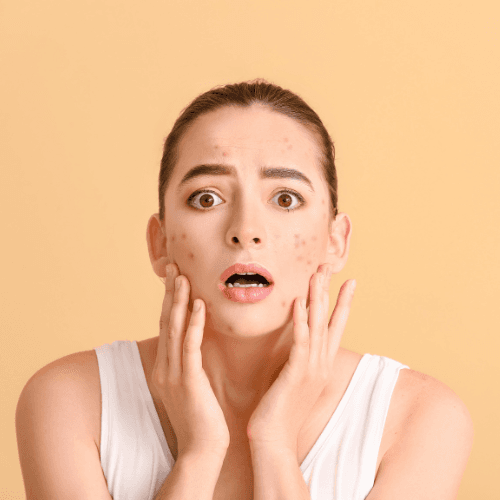 Dr. Salma - Hormonal Acne Treatment Specialist