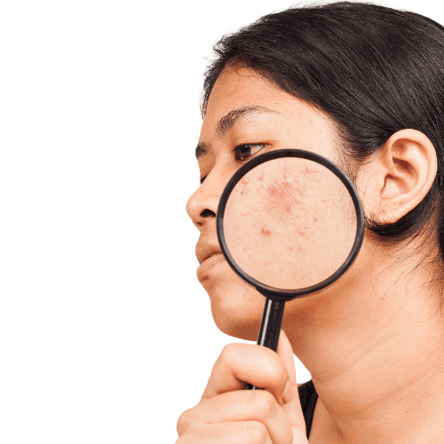 Foundation & Assessment - Hormonal Acne Treatment Journey